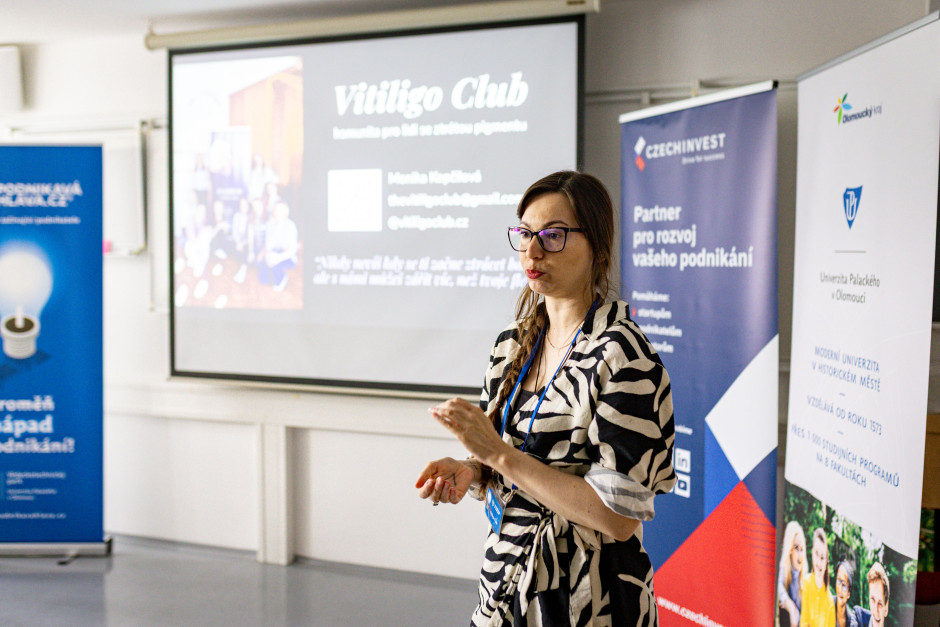 Monika Kopčilová a její projekt Vitiligo Club